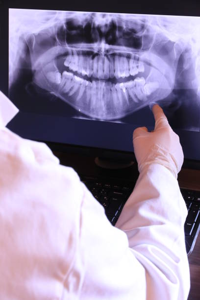 Best Emergency Tooth Extraction in Buckner, KY