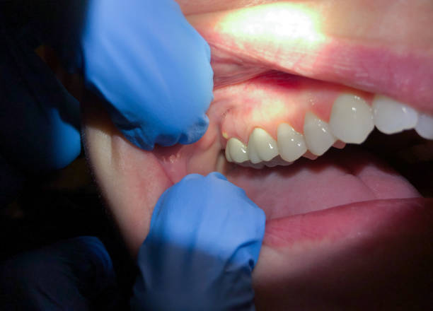 Best Emergency Denture Repair in Buckner, KY